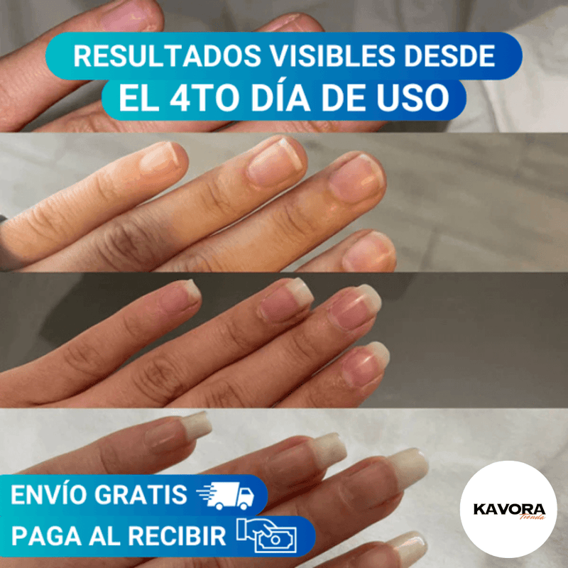 💅(COMPRA 1 & LLEVA 2)🎁 Serum Endurecedor 7 DÍAS - Uñas LARGAS y FUERTES + Envío Gratis